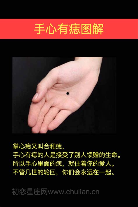 手心痣|掌心痣有什么含义 掌心痣相图解